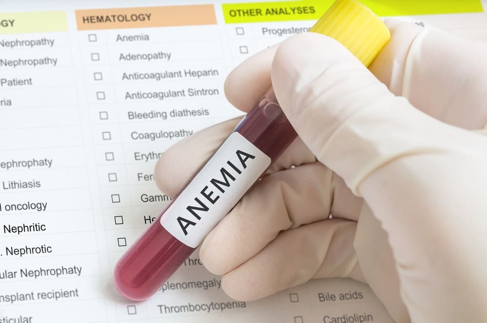 Anemia Markers Test
