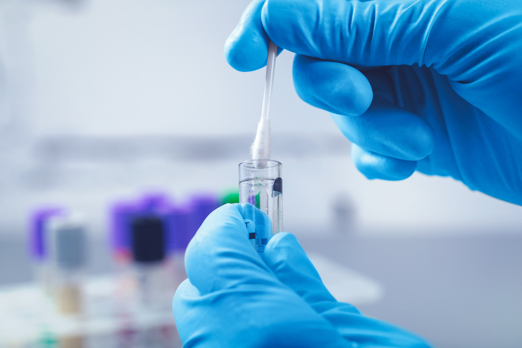 MTHFR Gene Testing